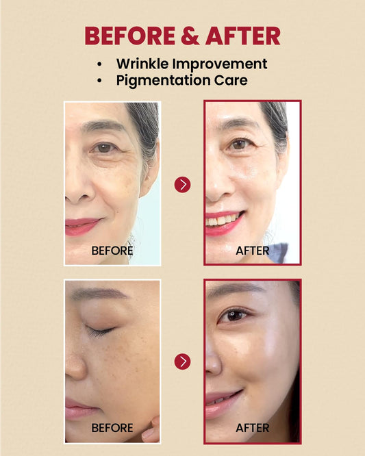 K‑SECRET - SEOUL 1988 Serum: Retinal Liposome 2% + Black Ginseng (Original)