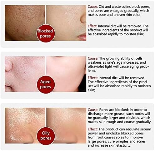 LANBENA - Pore Solution Serum (Original)